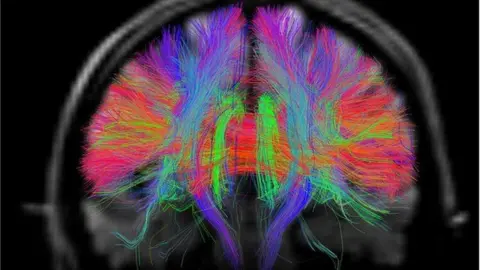 Yelzkizi Scientists Make Breakthrough That Allows Lab-Grown Brain Cells To Play A Sort Of Video Game (UC Santa Cruz Cart-Pole Results Explained)