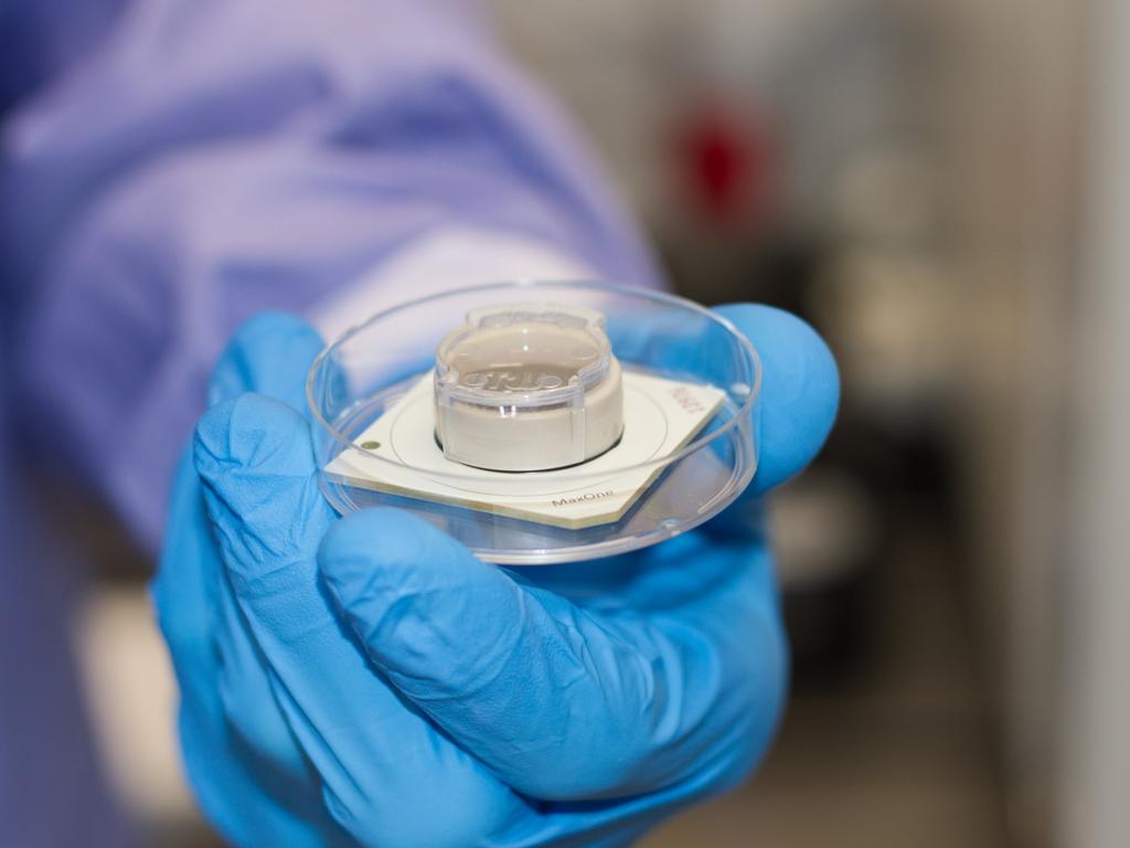 Yelzkizi Scientists Make Breakthrough That Allows Lab-Grown Brain Cells To Play A Sort Of Video Game (UC Santa Cruz Cart-Pole Results Explained)